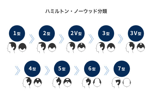 初めてのaga治療 Agaとは 原因 治療効果 副作用 Aga 薄毛治療の相談は発毛医療のdクリニック東京へ 21年255万人のaga治療実績 初めてのaga治療 Agaとは 原因 治療効果 副作用 Aga 薄毛治療の相談は発毛医療のdクリニック東京へ 21年255万人のaga治療実績