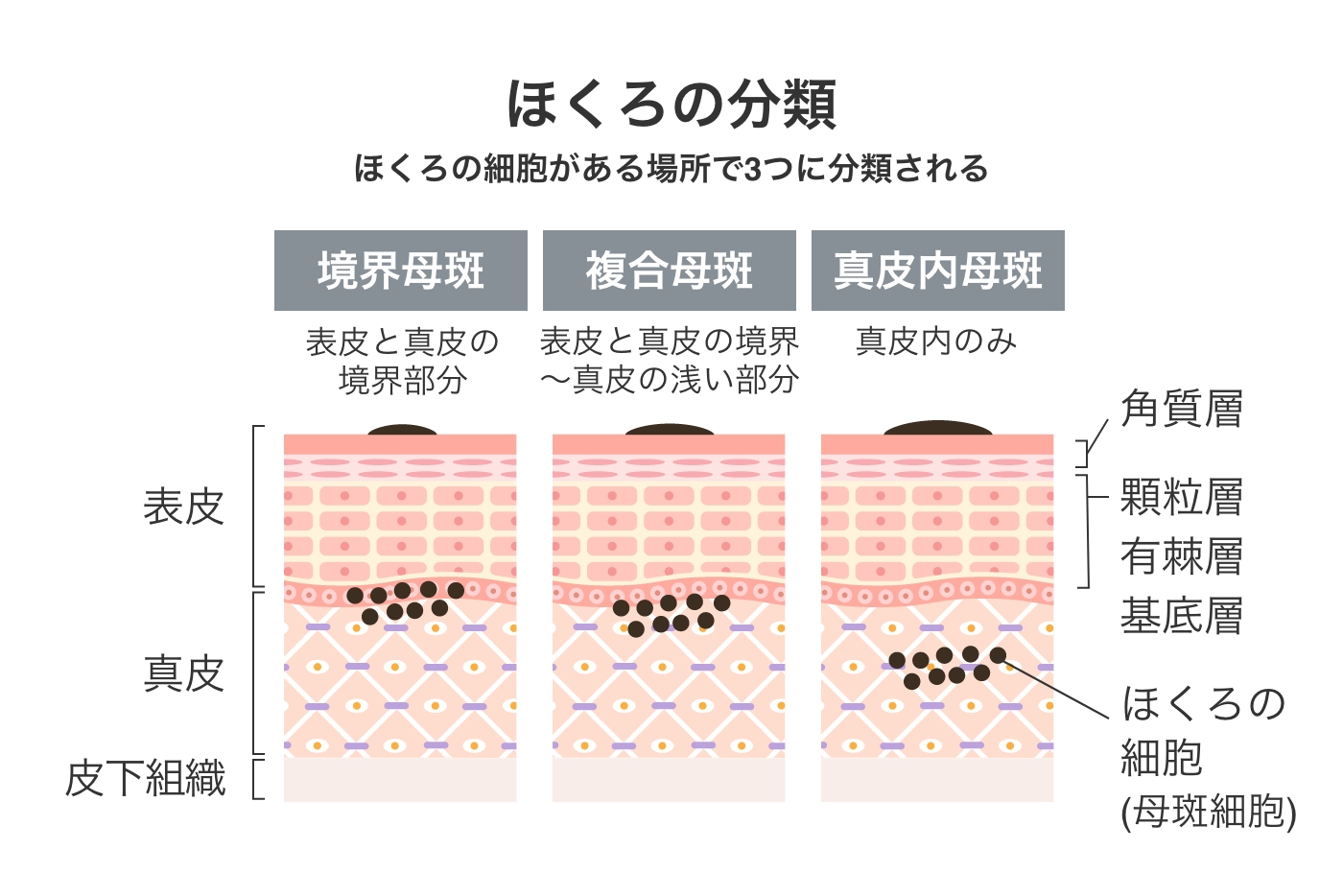 ほくろ ほくろができる原因と治療方法について Dクリニック東京plus